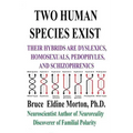 Two Human Species Exist: Their Hybrids Are Dylsexics, Homosexuals, Pedophiles, and Schizophrenics