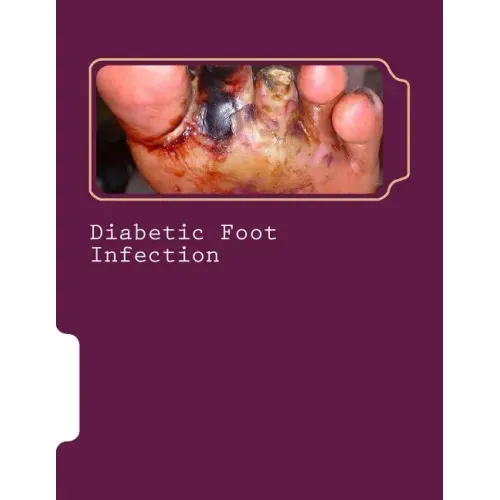 Diabetic Foot Infection