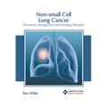 Non-Small Cell Lung Cancer: Prevention, Management and Emerging Therapies