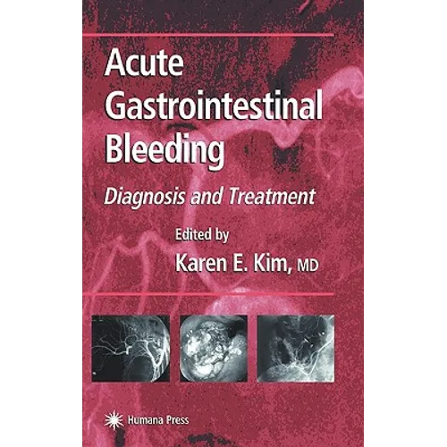 Acute Gastrointestinal Bleeding: Diagnosis and Treatment