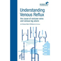 Understanding Venous Reflux the Cause of Varicose Veins and Venous Leg Ulcers: Varicose veins and venous leg ulcers