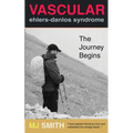Vascular Ehlers-Danlos Syndrome: The Journey Begins