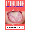 DIY Oral Thrush Natural Home Remedies: The Effective Step By Step Guide To Permanently End Oral Thrush