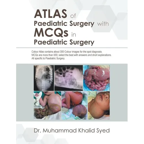 Atlas of Paediatric Surgery with Mcqs in Paediatric Surgery
