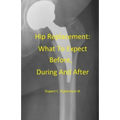 Hip Replacement: What To Expect Before, During and After