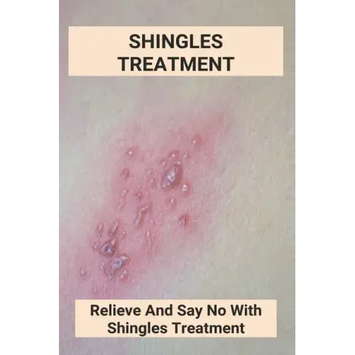 Shingles Treatment: Relieve And Say No With Shingles Treatment: Shingles On Face Treatment