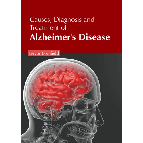 Causes, Diagnosis and Treatment of Alzheimer's Disease