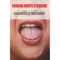 Burning Mouth Syndrome: Diagnosis & Treatment: Burning Mouth Syndrome Guide