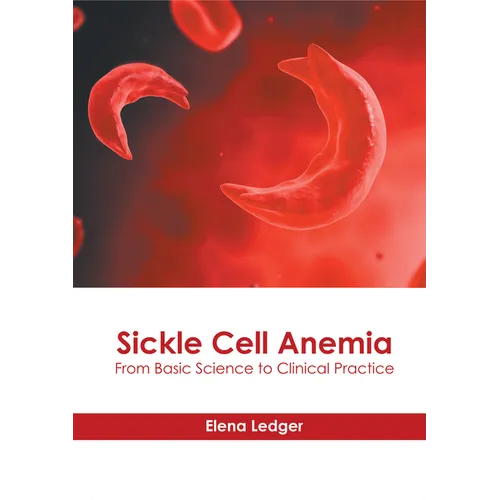 Sickle Cell Anemia: From Basic Science to Clinical Practice