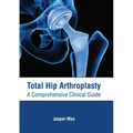 Total Hip Arthroplasty: A Comprehensive Clinical Guide