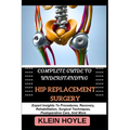 Complete Guide to Understanding Hip Replacement Surgery: Expert Insights To Procedures, Recovery, Rehabilitation, Surgical Techniques, Postoperative C