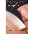 Acupuncture: The Natural Ways to do Acupressure Effectively to Treat Yourself