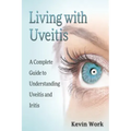 Living with Uveitis: A Complete Guide to Uveitis and Iritis