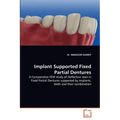 Implant Supported Fixed Partial Dentures