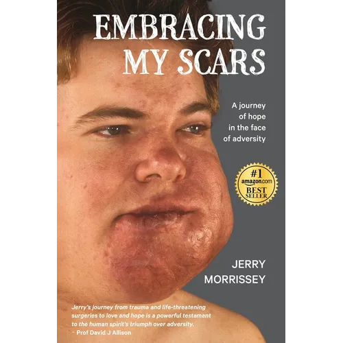 Embracing My Scars: A journey of hope in the face of adversity