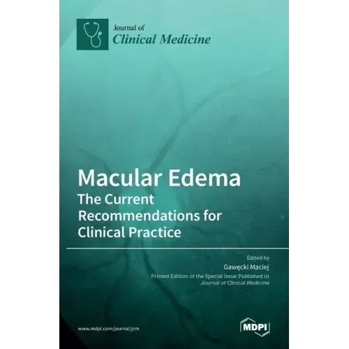 Macular Edema: The Current Recommendations for Clinical Practice