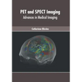 Pet and Spect Imaging: Advances in Medical Imaging