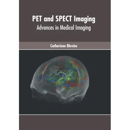 Pet and Spect Imaging: Advances in Medical Imaging