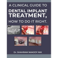 A clinical guide to dental implant treatment, how to do it right.