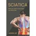 Sciatica: What You Need To Know About Your Back Pain
