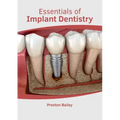 Essentials of Implant Dentistry
