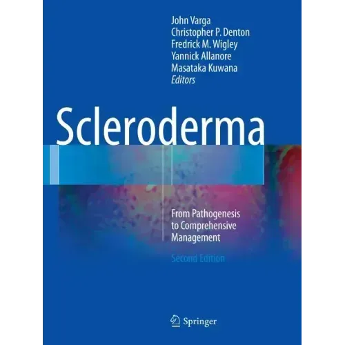 Scleroderma: From Pathogenesis to Comprehensive Management