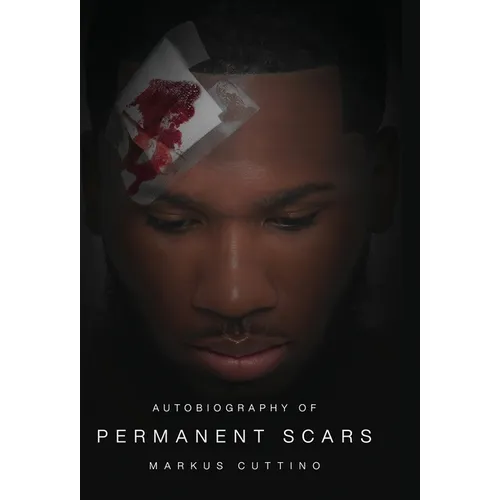 Permanent Scars