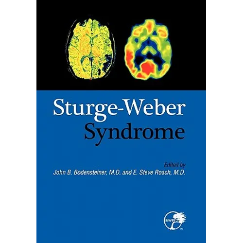 Sturge-Weber Syndrome