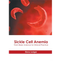 Sickle Cell Anemia: From Basic Science to Clinical Practice