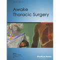 Awake Thoracic Surgery