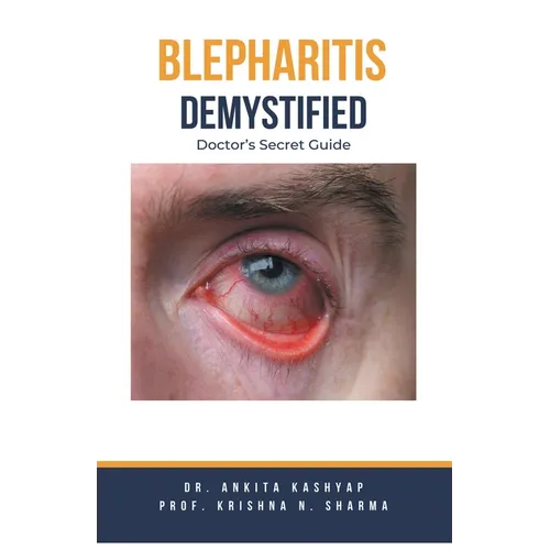 Blepharitis Demystified: Doctor's Secret Guide