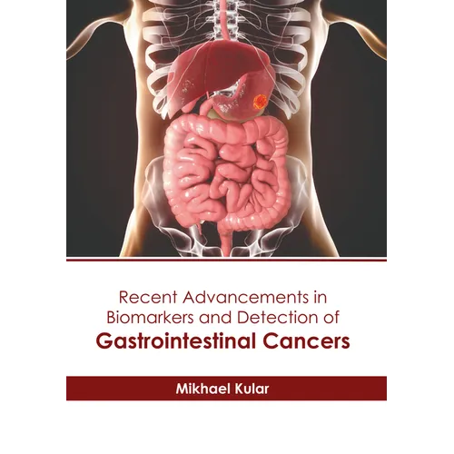 Recent Advancements in Biomarkers and Detection of Gastrointestinal Cancers