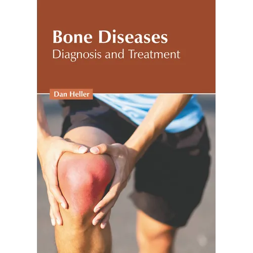 Bone Diseases: Diagnosis and Treatment
