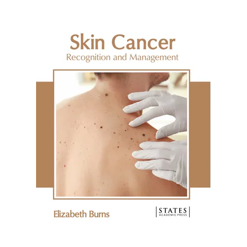 Skin Cancer: Recognition and Management