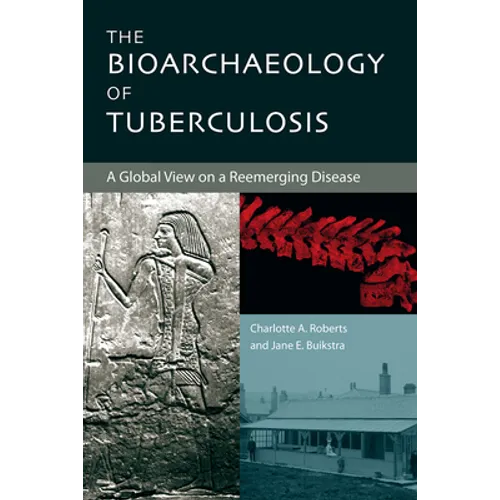 The Bioarchaeology of Tuberculosis: A Global View on a Reemerging Disease