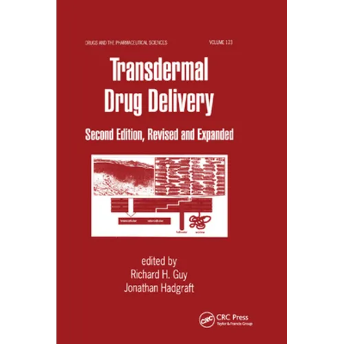 Transdermal Drug Delivery Systems: Revised and Expanded