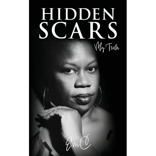 Hidden Scars: My Truth
