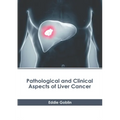 Pathological and Clinical Aspects of Liver Cancer