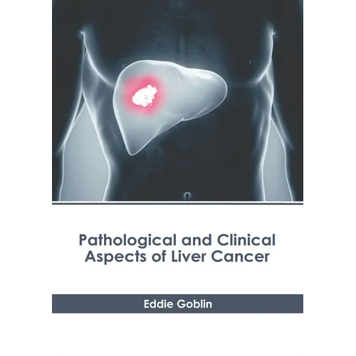 Pathological and Clinical Aspects of Liver Cancer