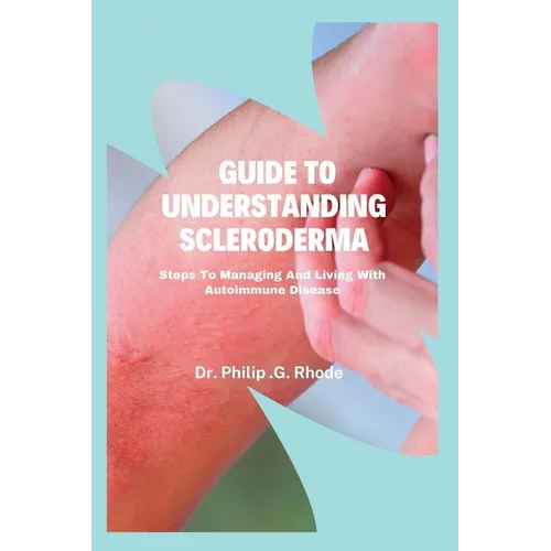 Guide to Understanding Scleroderma: Steps to managing and living with autoimmune disease