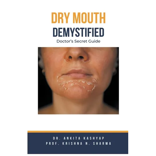 Dry mouth Demystified: Doctor's Secret Guide