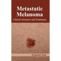 Metastatic Melanoma: Clinical Advances and Treatments