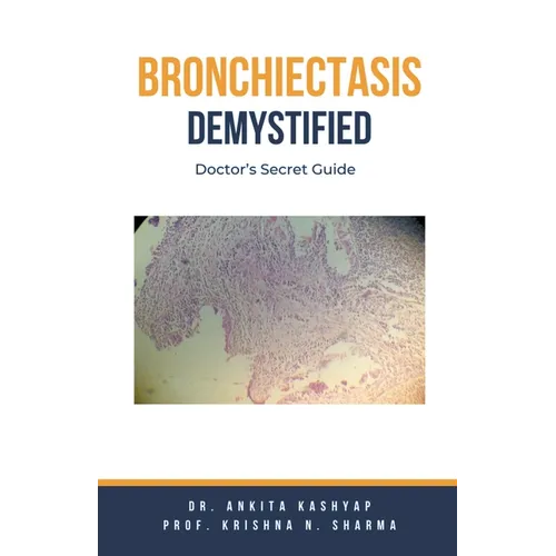Bronchiectasis Demystified: Doctor's Secret Guide