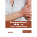 Autoimmune Diseases of the Skin: Pathogenesis, Diagnosis and Management