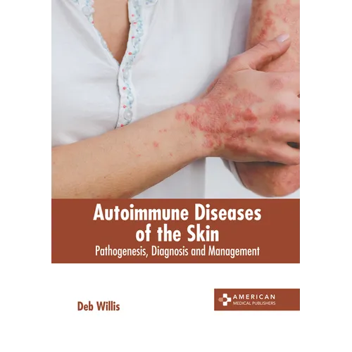Autoimmune Diseases of the Skin: Pathogenesis, Diagnosis and Management