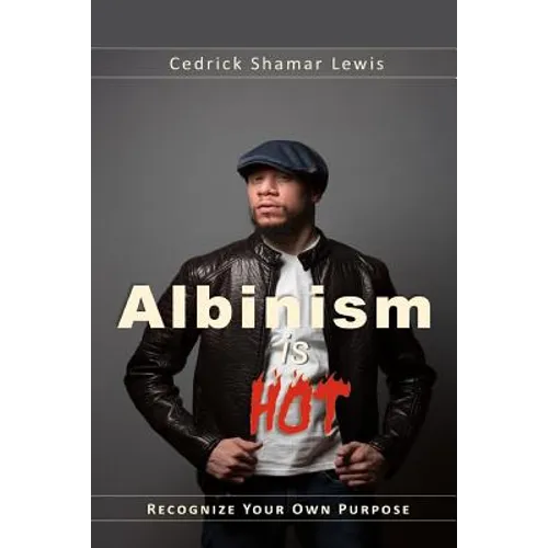 Albinism is Hot!