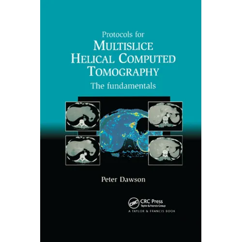 Protocols for Multislice Helical Computed Tomography: The Fundamentals