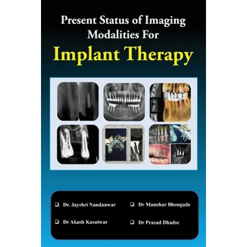 Present Status of Imaging Modalities For Implant Therapy