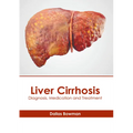 Liver Cirrhosis: Diagnosis, Medication and Treatment