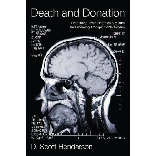 Death and Donation: Rethinking Brain Death as a Means for Procuring Transplantable Organs